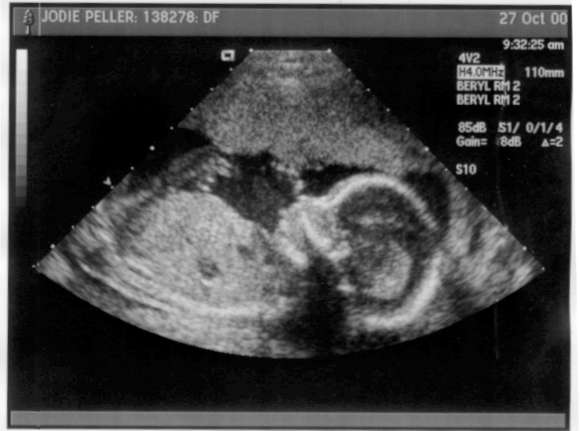 Baby Girl Peller