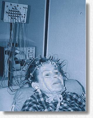 EEG (24K)