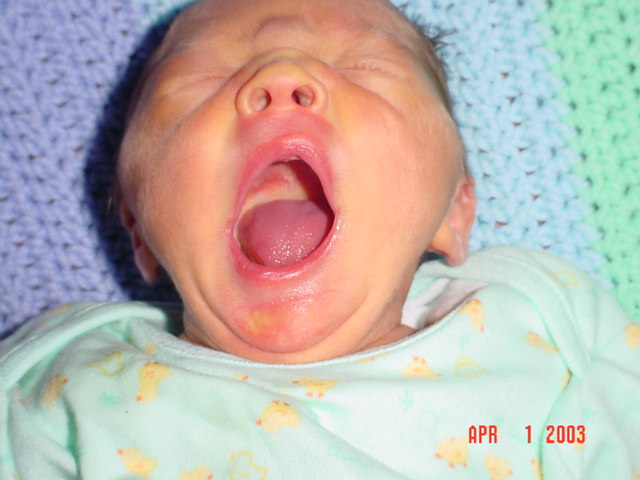 Yawning Mac